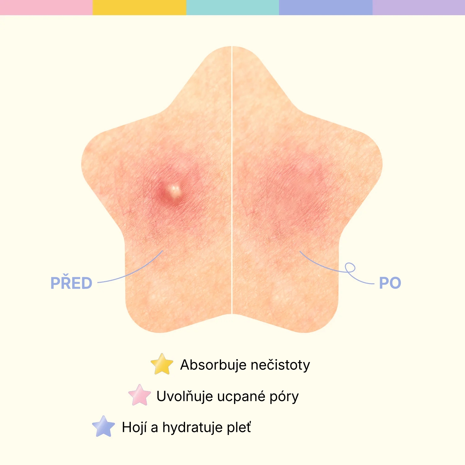 1.2. Detailed Page OOTD Star Spot Patch